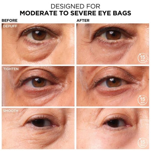 CONTORNO DE OJOS BYE BYE UNDER EYE BAGS 15ML - IT COSMETICS - Adrissa Beauty - Cuidado de la piel