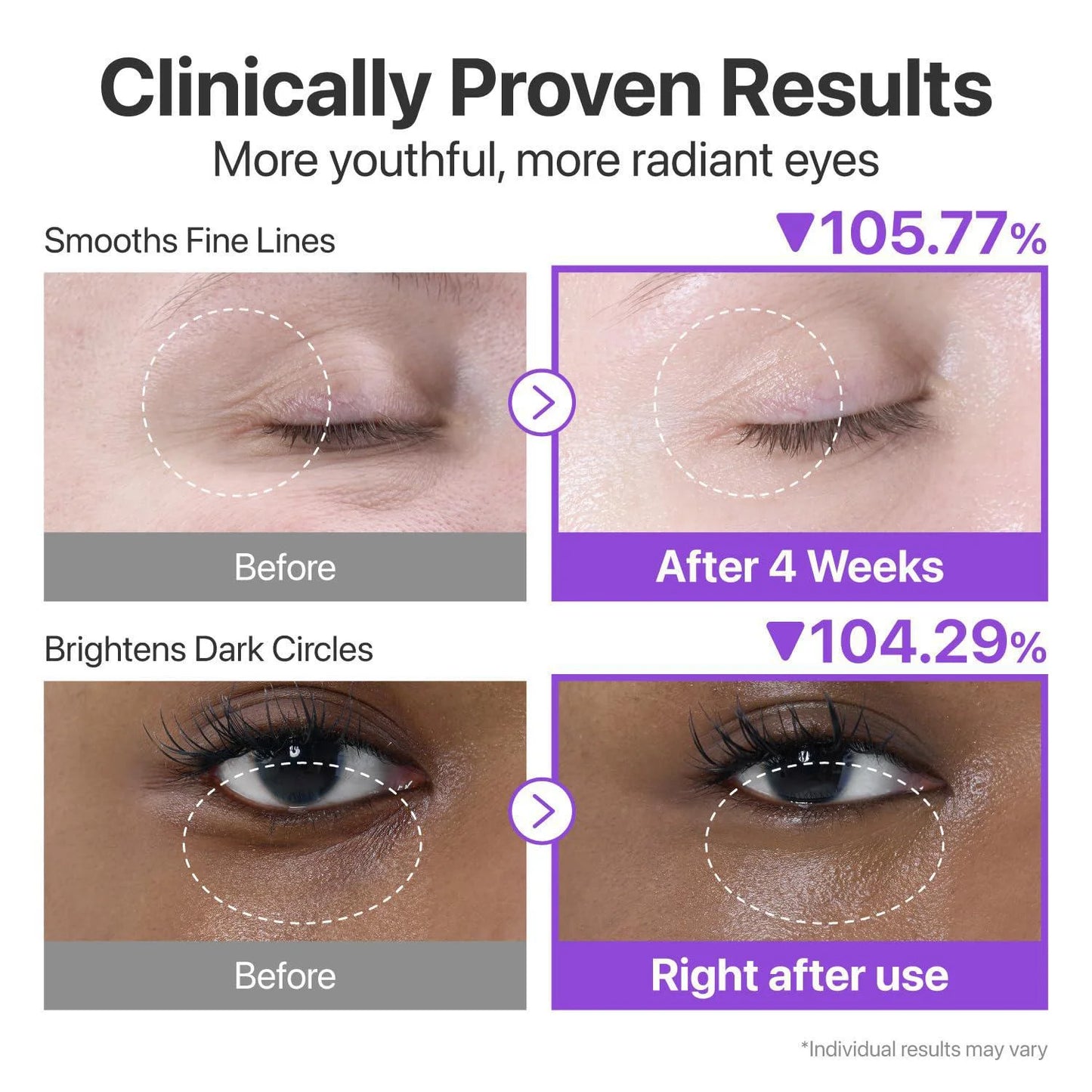 CONTORNO OJOS NAD RETINOL PEPTIDES 10ML - NUMBUZIN - Adrissa Beauty - Cuidado de la piel
