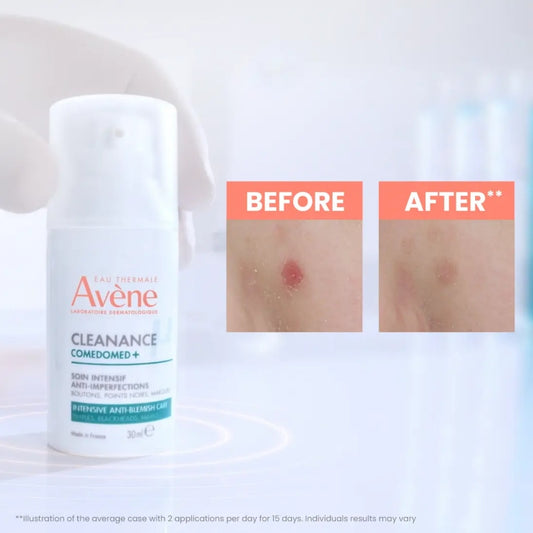 CREMA CLEANANCE COMEDOMED ANTIIMPERFECCIONES 30ML - AVENE - Adrissa Beauty - Cuidado de la piel