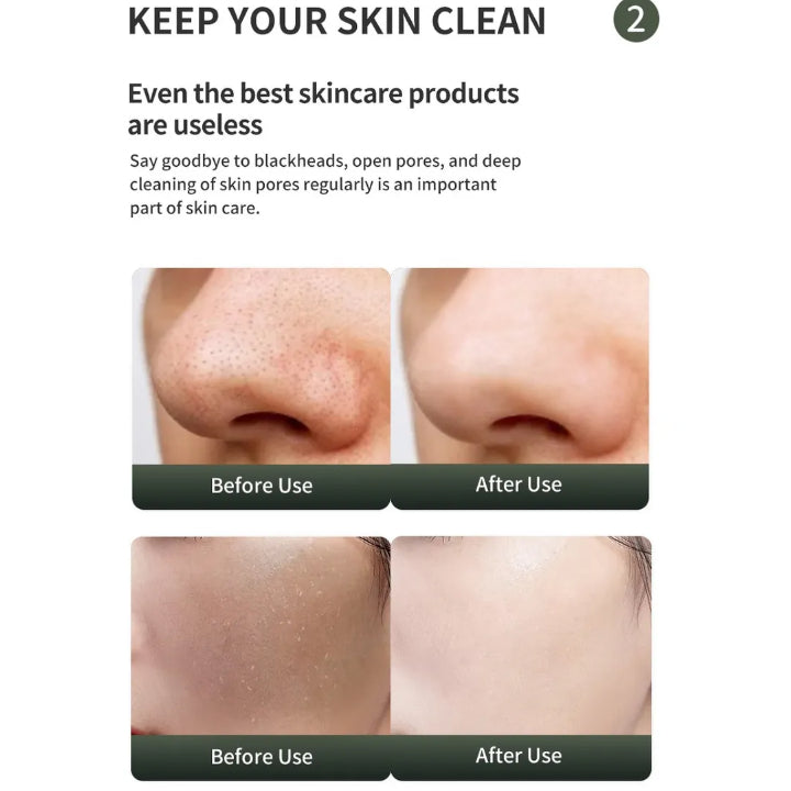 DISPOSITIVO SKIN SCRUBBER ULTRASONICA 3EN1 - MRC3 - Adrissa Beauty - Electrónica