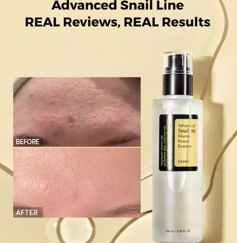 ESENCIA DE CARACOL ADVANCED SNAIL 96 MUCIN 100ML - COSRX - Adrissa Beauty - Cuidado de la piel