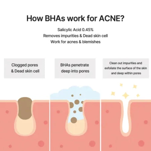 LIMPIADOR JI WOO GAE CICA BHA ACNE FOAM 150ML