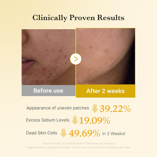 PADS KOJIC ACID TURMERIC NIACINAMIDE 5 70PADS - MEDICUBE - Adrissa Beauty - Cuidado de la piel