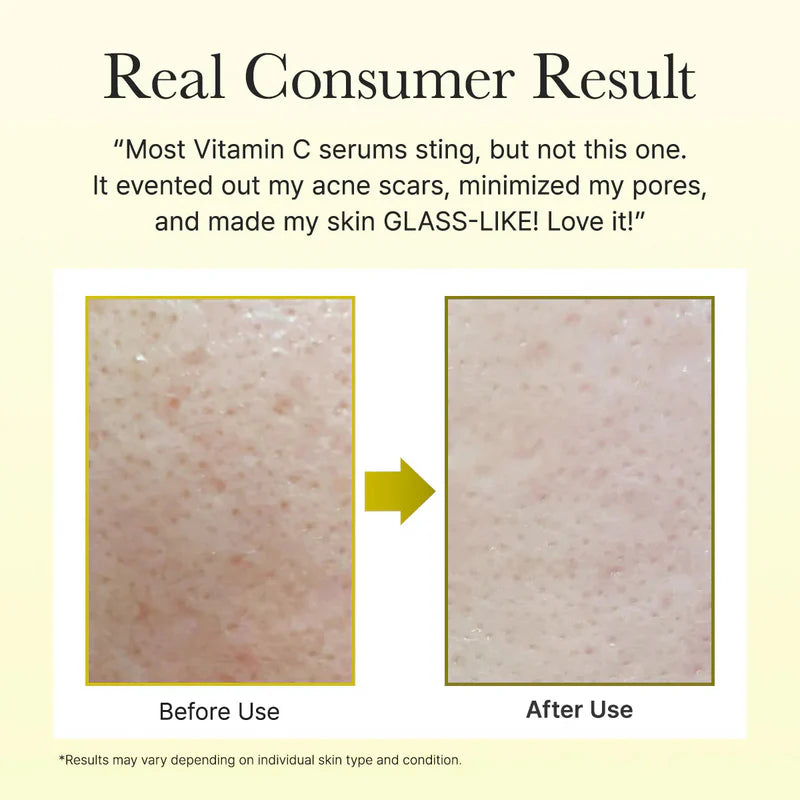 VITAMINA C BOOSTER SHOT BRIGHTENING 30ML - ARENCIA - Adrissa Beauty - Cuidado de la piel