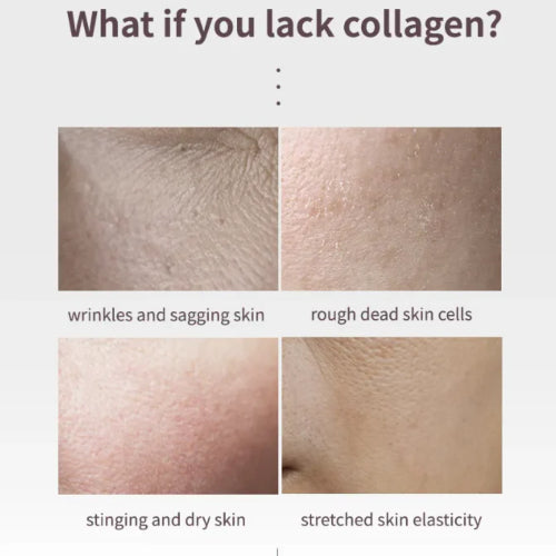 BALSAMO ANTI ARRUGAS WRINKLE COLLAGEN VITA 10GR