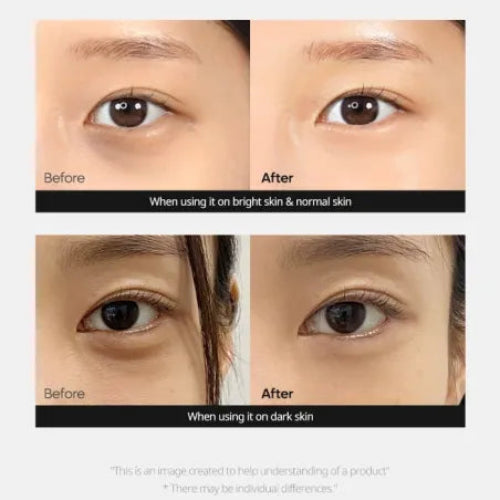 CONTORNO OJOS CALCIUM DARK SPOT COVER 15GR - DR MELAXIN - Adrissa Beauty - Cuidado de la piel