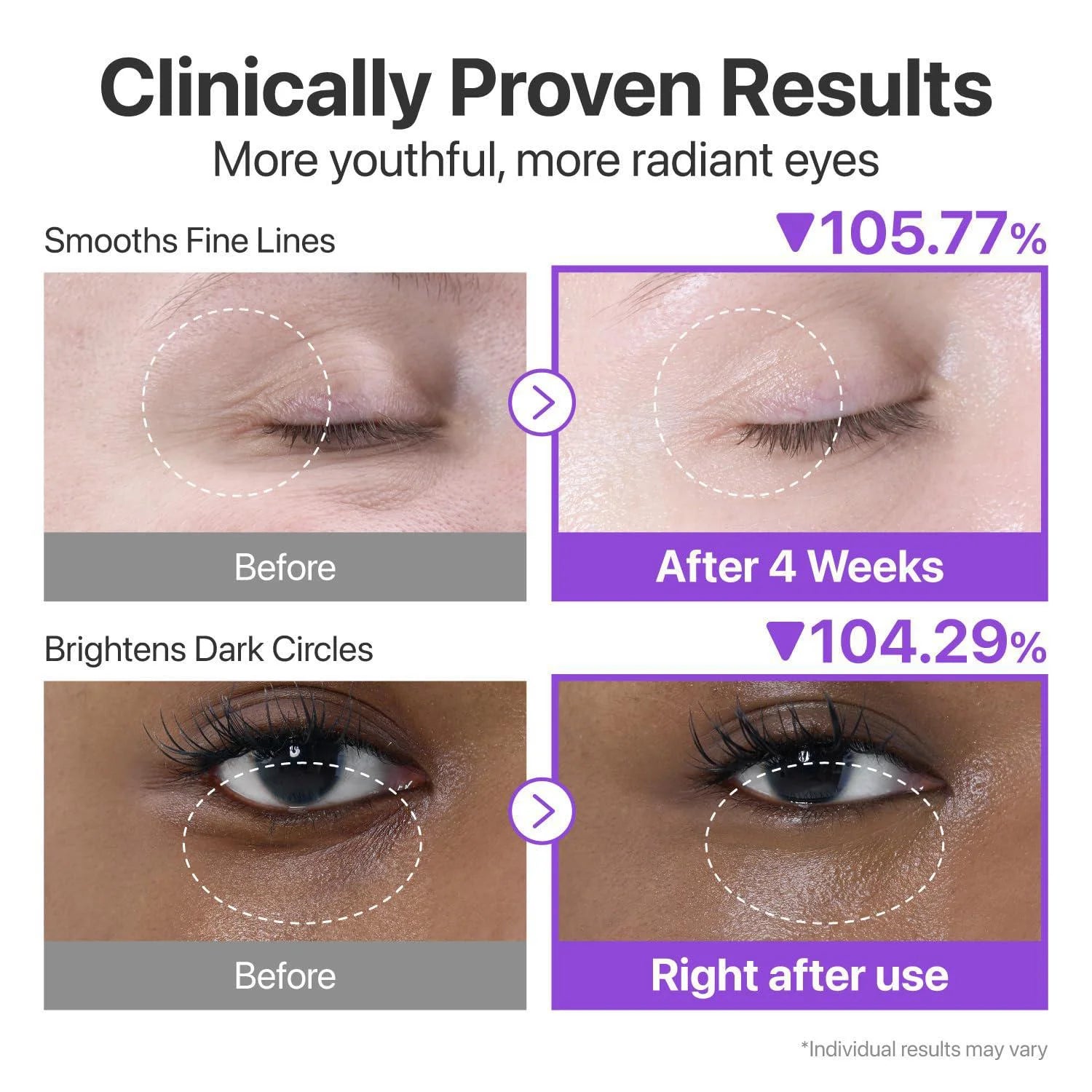 CONTORNO OJOS NAD RETINOL PEPTIDES 10ML - NUMBUZIN - Adrissa Beauty - Cuidado de la piel