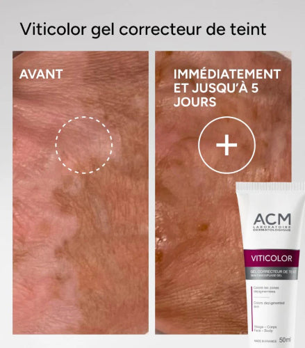 GEL DESPIGMENTANTE VITICOLOR ROSTRO Y CUERPO 50ML - ACM - Adrissa Beauty - Cuidado de la piel