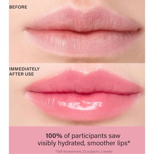 LIP TREATMENT VEGAN COLLAGEN 2 ROSE - MELIXIR - Adrissa Beauty - Cuidado labial