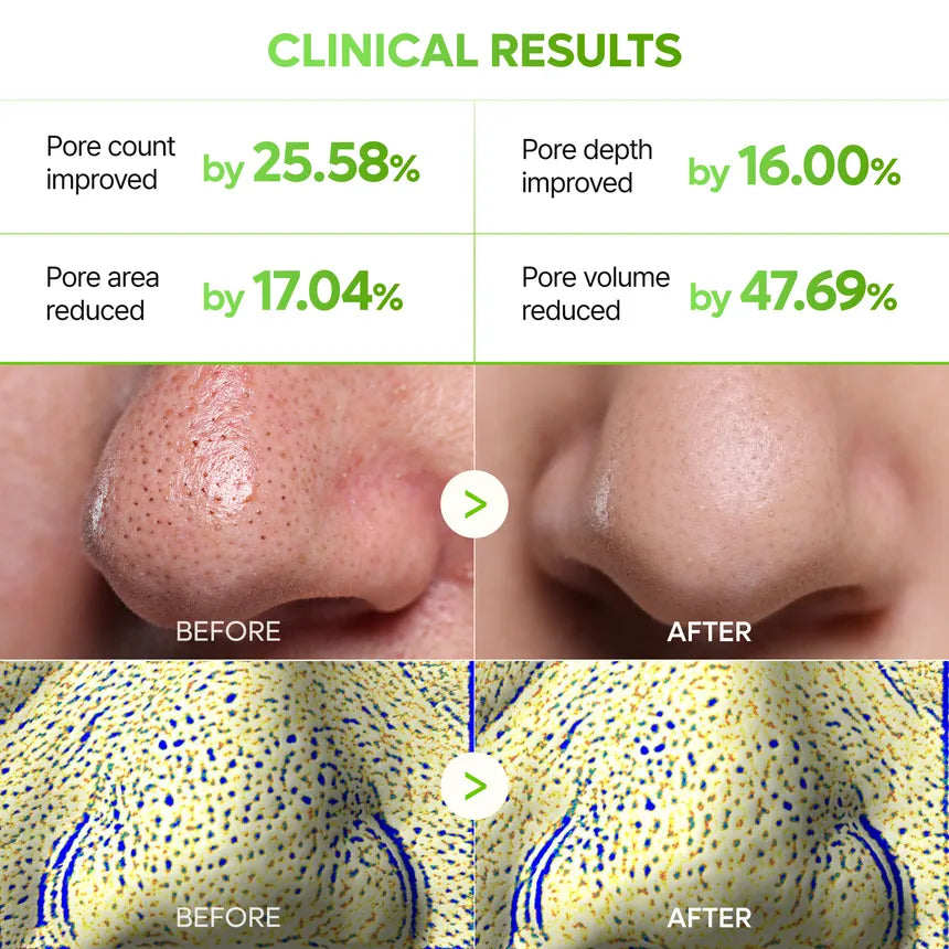MASCARILLA CACTOX 3 PASOS POROS NARIZ - DR MELAXIN - Adrissa Beauty - Cuidado de la piel