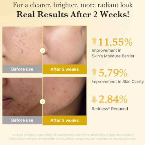 SERUM KOJIC ACID TURMERIC NIACINAMIDE 5 30ML - MEDICUBE - Adrissa Beauty - Cuidado de la piel