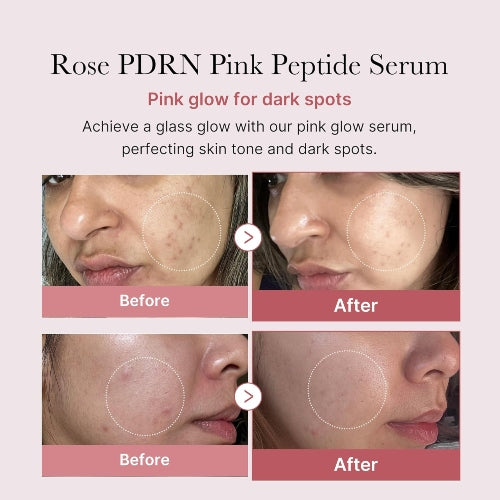 SERUM PDRN PINK PEPTIDE 30ML - MEDICUBE - Adrissa Beauty - Cuidado de la piel